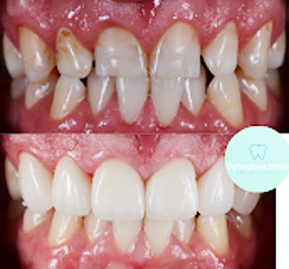 One Family Dental